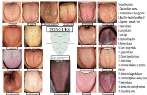 Tongue in Cheek Tongue Diagnosis