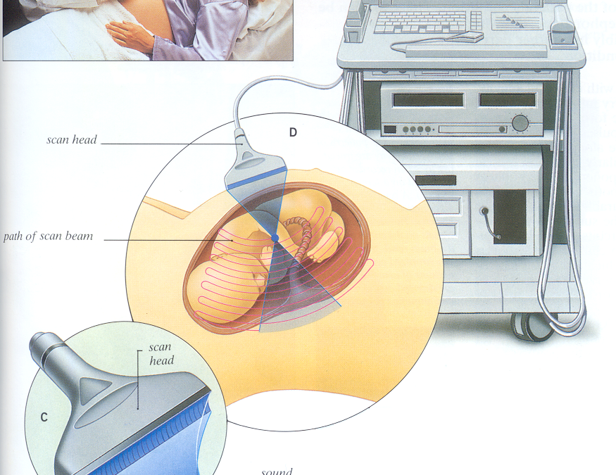 Blog – Diagnostic Tools ultrasound-3